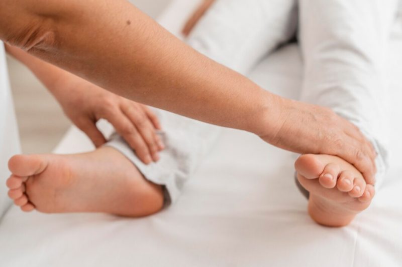 Bunions