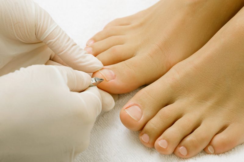 toenail